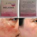 Bioaqua P Vita Melasma Mesta Whitening Cream -10 gm (Thailand) - Image 6